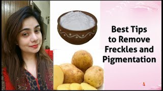 Lockdown Home Care | Best Ways to Remove Freckles | Melasma | Pigmentation