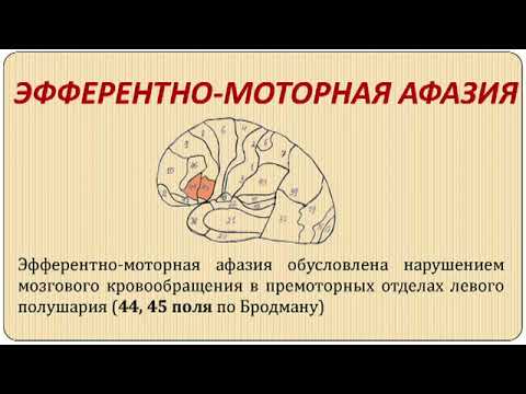 Эфферентная моторная аграфия