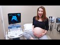 Amazing News About Our Baby! - 28 Week Pregnancy Ultrasound