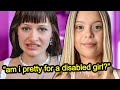 This OF Girl Fakes Disabilities For Views
