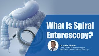 What Is Spiral Enteroscopy | Medicover Hospitals
