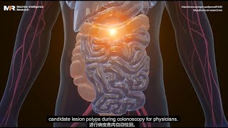 Celebrity 【MIR Series】Video Polyp Segmentation: A Deep Learning Perspective Wealth