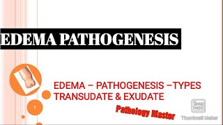 EDEMA - Pathogenesis Of Development