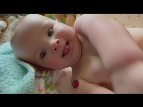 Video: Sådan genkender og behandler jordbærfødsler (Harmangiomas) - Baby Health A-Z