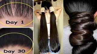 30 Days Long Hair Growth Challenge - खोए हुए बाल वापिस उगाए घने काले लंबे बाल रस्सी जैसे मोटे होंगे