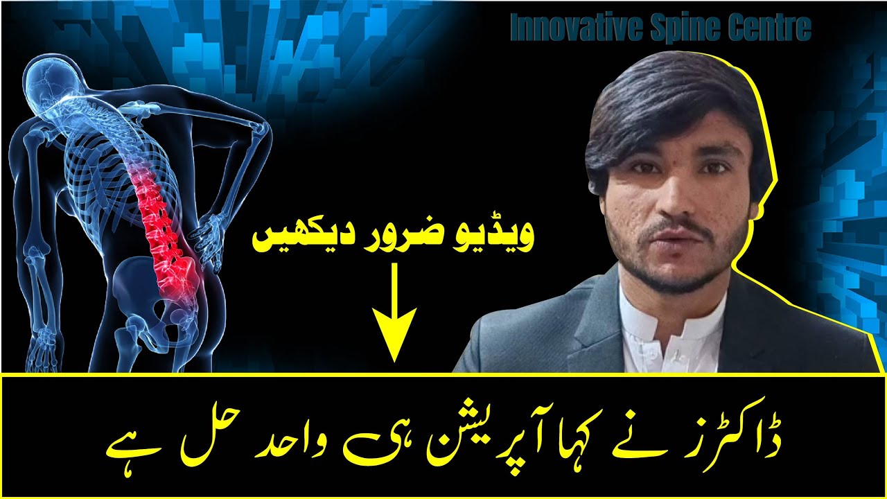 Back Pain Recovery Without Surgery | Patient Review | Innovative Spine Centre