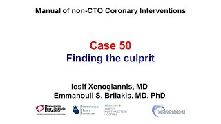 Case 50: PCI Manual - Finding the culprit