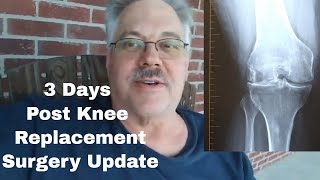 3 Days After Total Knee Replacement Surgery Update