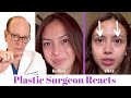 Getting Eyelid Surgery (Blepharoplasty) | Plastic Surgeon Reacts