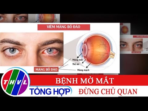 Đừng chủ quan với bệnh mờ mắt