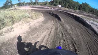Mx 101 b