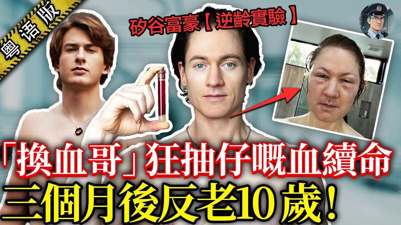 起底矽谷抗衰呃局：富豪燒錢嗑藥換血，差啲被神藥攞命😱 背後條產業鏈爆賺到盆滿缽滿！