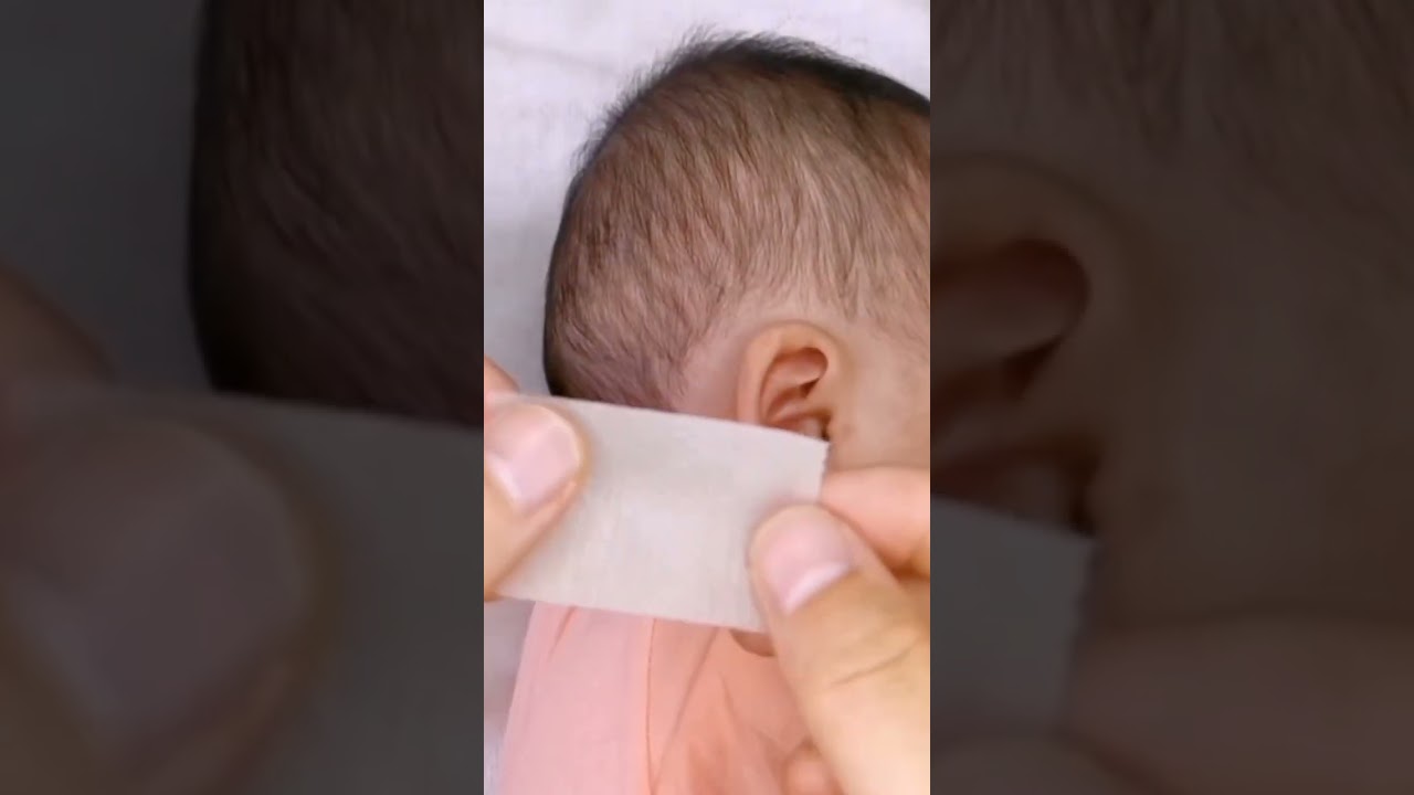 Baby Silicone Gel Ear Corrector.