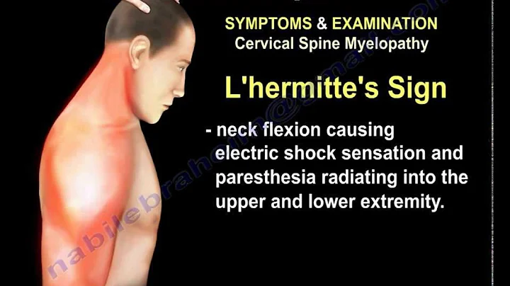 Conditions Affecting The Cervical Spine - Everything You Need To Know - Dr. Nabil Ebraheim