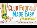 CLUB FOOT Pathoanatomy Made Easy - The Young ... - YouTube