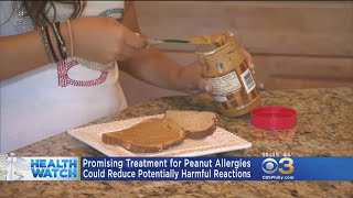 Promising Treatment For Peanut Allergies Awaits FDA Review