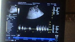 Baby Ryland 9w5d