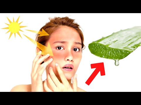 Video: 10 viisi herilase või herilase nõelamisest tingitud haavade ravimiseks