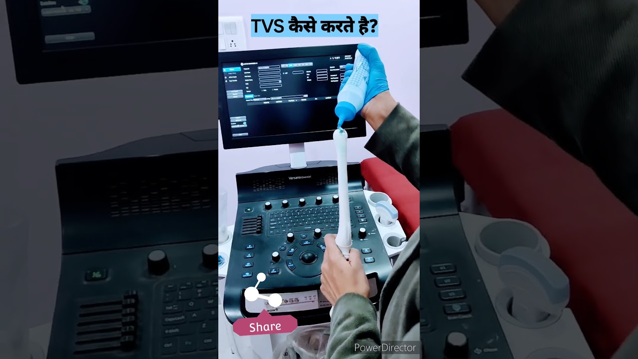 TVS#transvaginal sonography #ultrasound #gynecologist #gyne #doctorslife