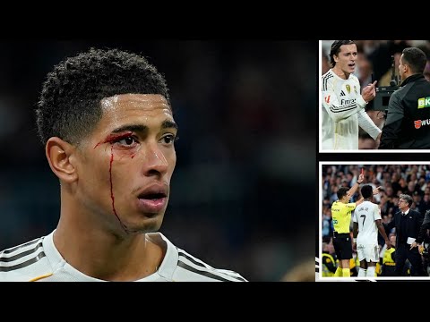 مؤلم للعين جود بيلينجهام ترك دماء على جسده بعد طرد ثلاثة لاعبين في هزيمة ريال مدريد الفوضوية 