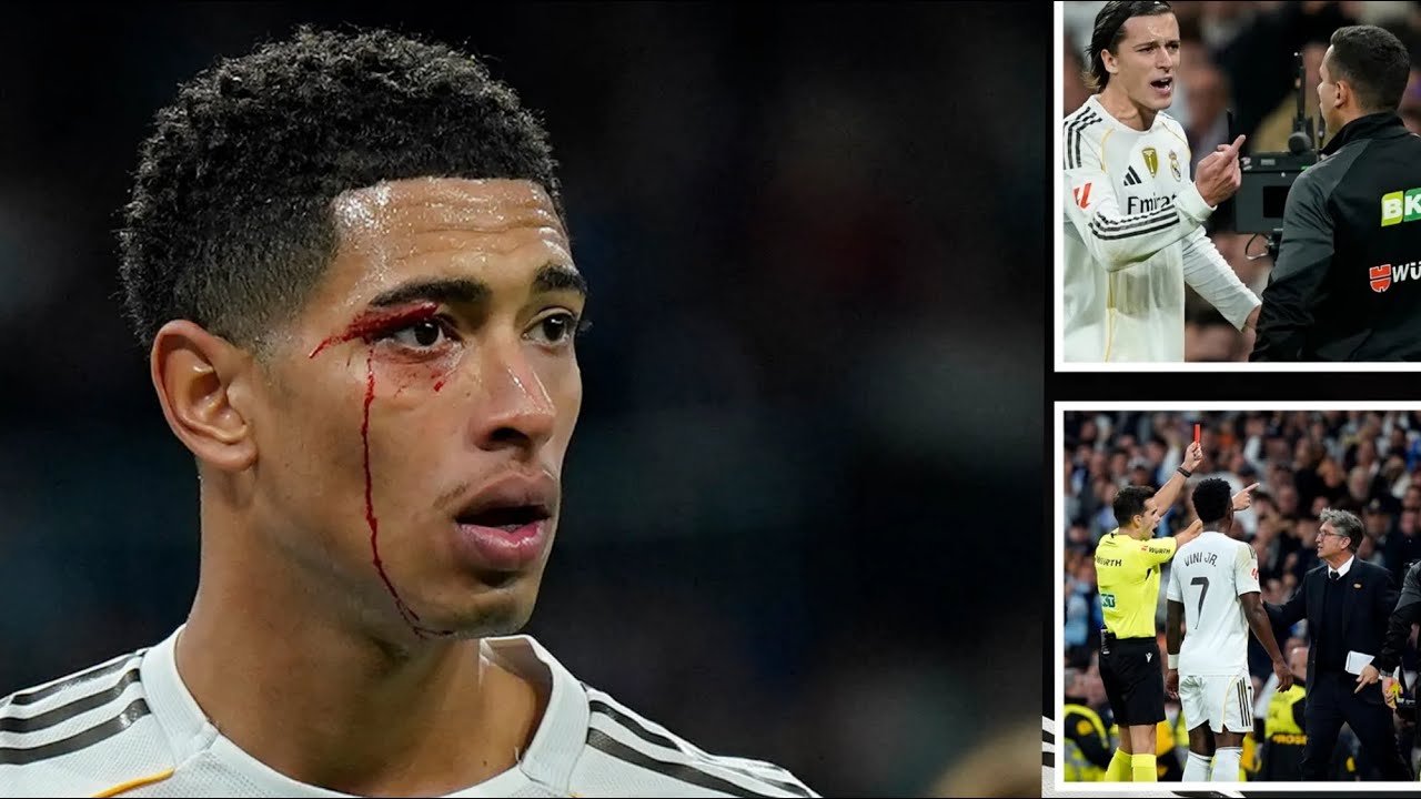 БОЛЬ В ГЛАЗАХ: Джуд Беллингем остался без крови после того, как трое игроков были удалены с поля ...