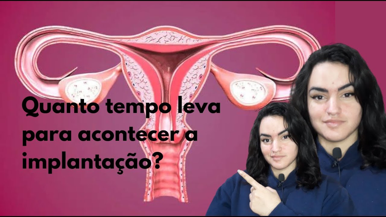QUANTO TEMPO APÓS A RELAÇÃO ACONTECE A IMPLANTAÇÃO? QUANTO TEMPOS APÓS ...