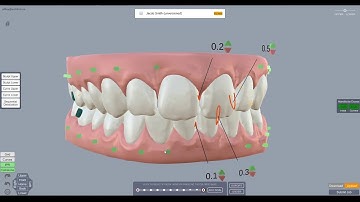 ArchForm Tutorial - How Staging is Calculated and How to Adjust it