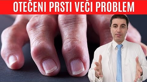 Kada su OTEČENI PRSTI veliki problem? Liječe se na ovaj način...