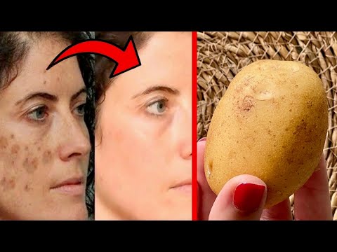Video: Jak si vyrobit bramborovou pleťovou masku: 6 kroků (s obrázky)