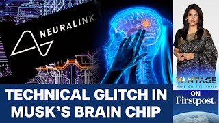 Information Elon Musk’s Neuralink Had a Brain Implant Setback. Is it all bad | Vantage with Palki Sharma Update