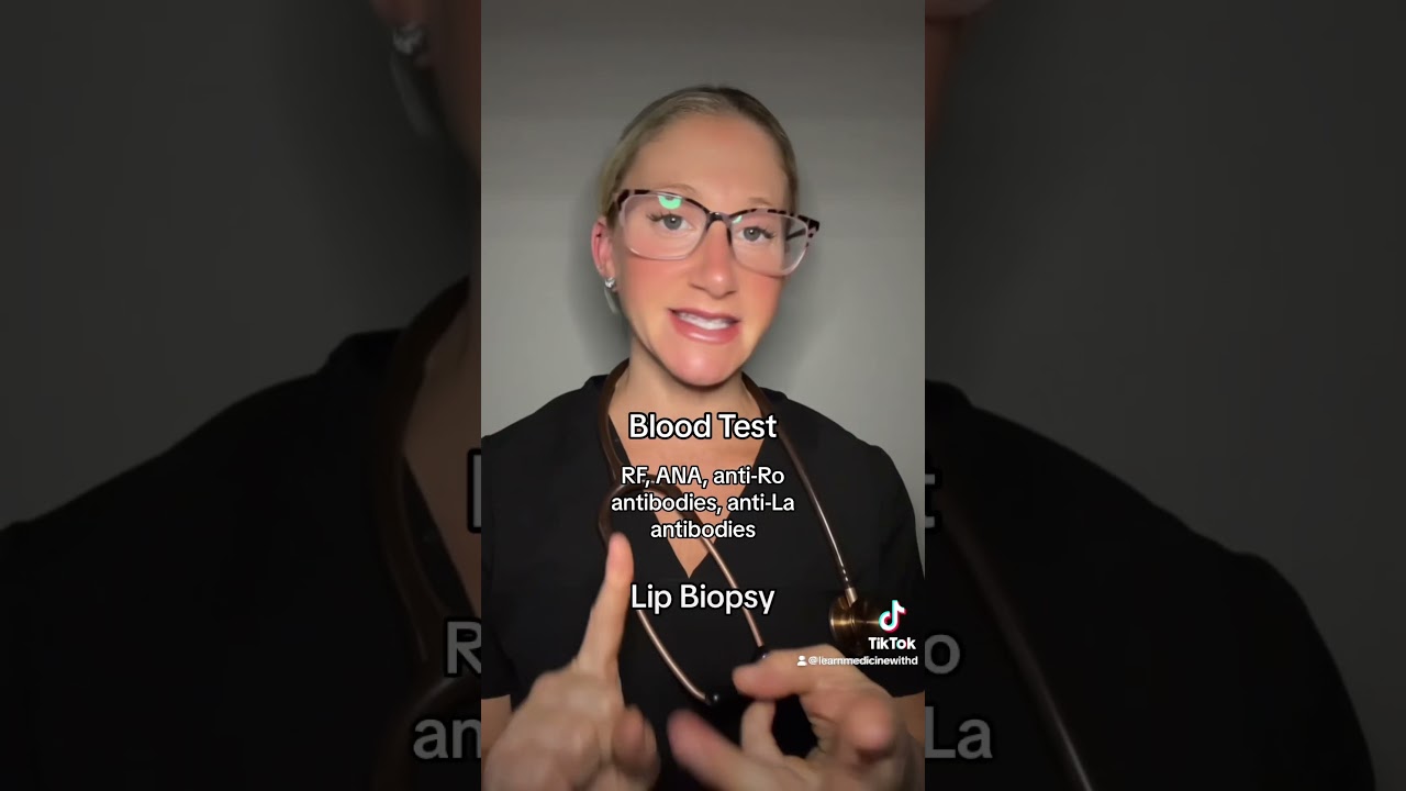 Sjogren’s Syndrome 