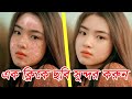 কিভাবে ছবি সুন্দর করা যায়, Photoshop Tutorial Bangla, How to Skin Retouching in Bangla