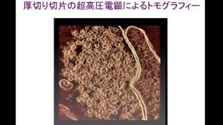 「よくわかる生物電子顕微鏡法　最新の標本作製技術が解き明かすミクロ（細胞）の世界」（臼倉治郎・名古屋大学）[#013]