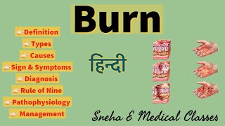 Burn !! Causes !! Types !! Symptoms !! Diagnosis !! Management !! Hindi !!