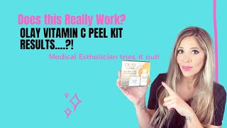 Medical Esthetician Final results of Olay Peel vs Spa Peel plus see some other masks I tried