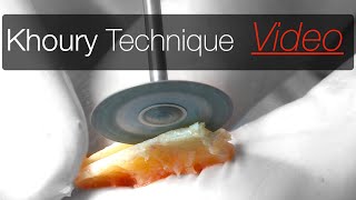 Khoury technique Surgical video: How is performed