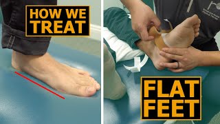 How We Treat Flat Feet | Collapsed Arches | Physical Therapy