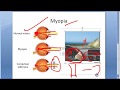 Ophthalmology 048 a Myopia Short Sightedness Eye Near Sight