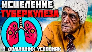 ЛЕЧЕНИЕ ТУБЕРКУЛЕЗА