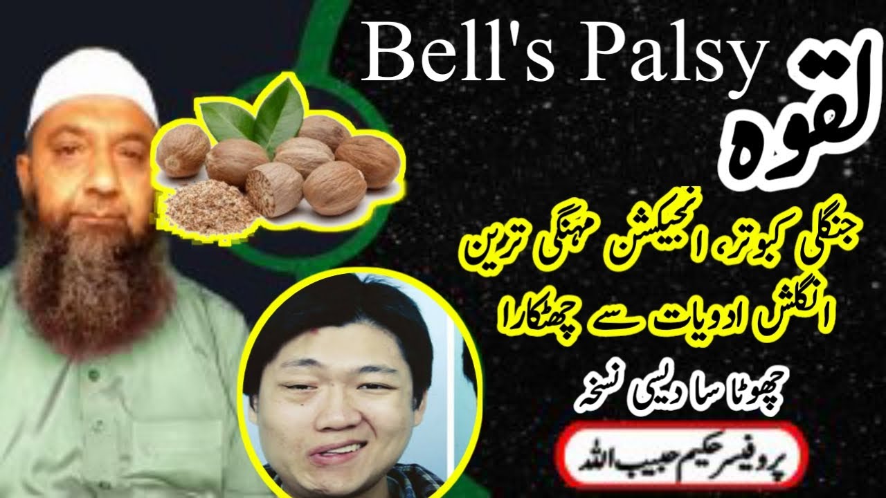 Facial Paralysis Treatment In Urdu / Hindi Laqwa Ka Ilaj By Hakeem