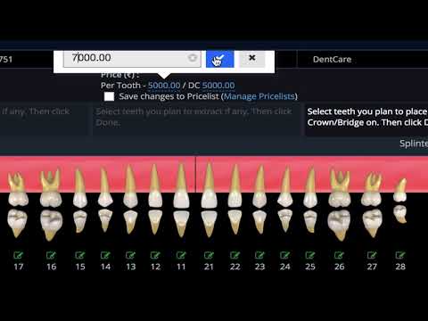 DrOrbis Dental Charting Explained - video from Dr Orbis