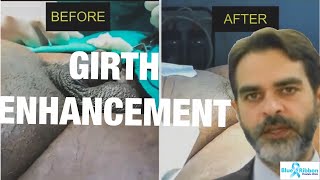 penile enlargement surgery before and after | girth enhancement results screenshot 5