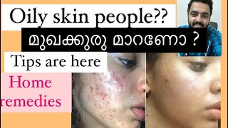 ഓയല സകൻ പർണമയ മററ 5 Tips To Reduce Oily Skin Acne Prone Skin -Routine