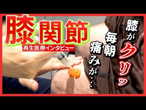 半月板損傷・変形性膝関節症】手術の宣告も再生医療（幹細胞治療）を