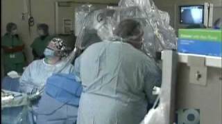 Robotic Hysterectomy