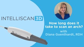 Intelliscan 3D FAQ - How long does it take to scan an arch