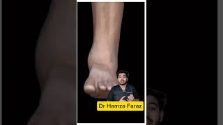 Ankle joint movement and dislocation anatomy 3d explained #anatomy