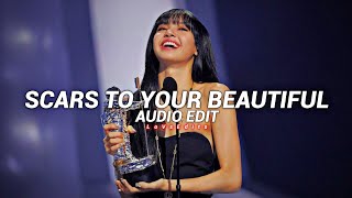 Alessia Cara - Scars To Your Beautiful { Audio Edit } - #LoVsEdits2