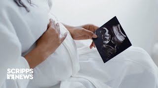 How doulas can help deliver better birthing outcomes