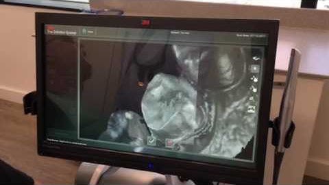 3M True Definition Scanner